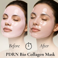 PDRN Bio Collagen Mask before and after comparison
