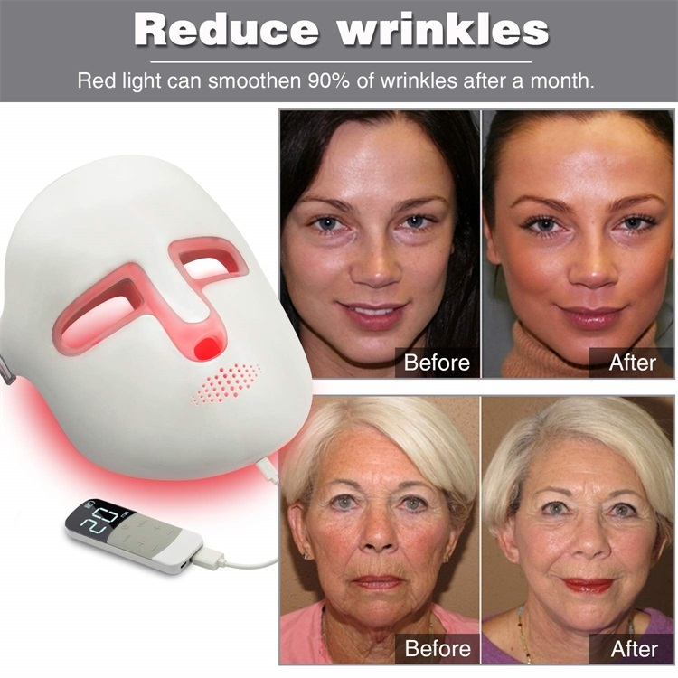 LED facial mask red light therapy showing before and after wrinkle reduction results - smoothen 90% of wrinkles after a month