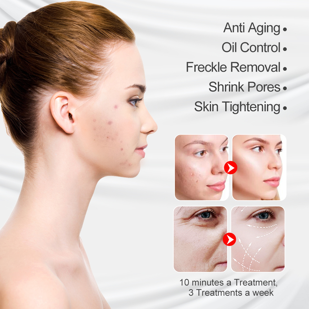 LED mask before and after results showing anti-aging and skin tightening benefits